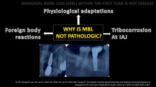 MARGINAL BONE LOSS (MBL) WITHIN THE FIRST YEAR IS NOT DISEASE
Fu PS, Tseng FC, Lan TH, Lai PL, Chen CH, Chen JH, Liu CT, Chen WC, Hung CC. Immediate implant placement with and without provisionalization: A
comparison of a one-year longitudinal study. J Dent Sci. 2023 Jul;18(3):1361-1367.
 