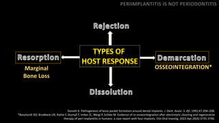 Donath K. Pathogenesis of bony pocket formation around dental implants. J. Dent. Assoc. S. Afr. 1992;47:204–208.
*Bosshardt DD, Brodbeck UR, Rathe F, Stumpf T, Imber JC, Weigl P, Schlee M. Evidence of re-osseointegration after electrolytic cleaning and regenerative
therapy of peri-implantitis in humans: a case report with four implants. Clin Oral Investig. 2022 Apr;26(4):3735-3746.
PERIIMPLANTITIS IS NOT PERIODONTITIS
Marginal
Bone Loss
OSSEOINTEGRATION*
 