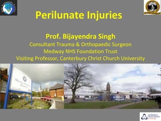 Perilunate Injuries
1
Prof. Bijayendra Singh
Consultant Trauma & Orthopaedic Surgeon
Medway NHS Foundation Trust
Visiting Professor, Canterbury Christ Church University
 