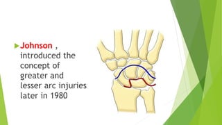Perilunate injuries and lunate dislocations [Autosaved].pptx