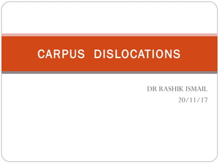 DR RASHIK ISMAIL
20/11/17
CARPUS DISLOCATIONS
 