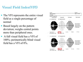 Visual Field Index(VFI)
 The VFI represents the entire visual
field as a single percentage of
normal
 Based largely on the pattern
deviation; weighs central points
more than peripheral ones.
 A full visual field has a VFI of
100%; perimetrically blind visual
field has a VFI of 0%.
 