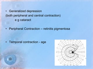 Contraction Visual Field Visual Field Examination | PPTX
