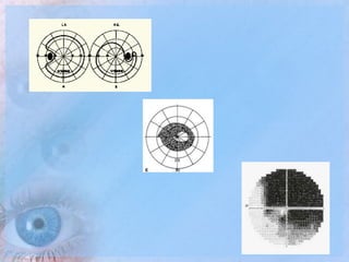 Visual Field Examination | PPTX