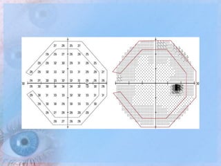 Visual Field Roll Paper Visual Field Examination | PPTX