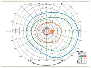G R Reddy Perimetry Perimetry | PPTX