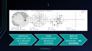 I
GRAYSCALE
LOOKS LIKE THAT
OF A ARCUATE
SCOTOMA
TOTAL
DEVIATION ALSO
REVEALS A
SCOTOMA
BUT, ON
PATTERN
DEVIATION…..NO
SCOTOMA
CATARACT
 