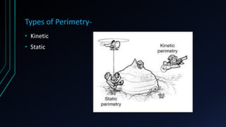 Types of Perimetry-
• Kinetic
• Static
 