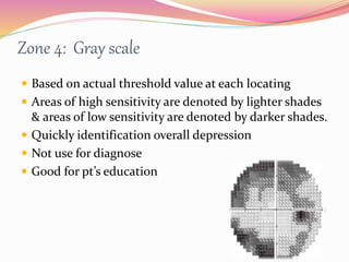 Zone 4: Gray scale
 Based on actual threshold value at each locating
 Areas of high sensitivity are denoted by lighter shades
& areas of low sensitivity are denoted by darker shades.
 Quickly identification overall depression
 Not use for diagnose
 Good for pt’s education
 