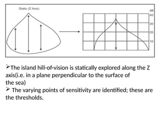 Primetry PERIMETRY.. .pptx