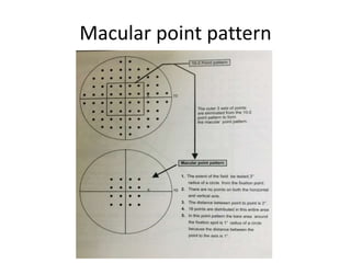 Macular point pattern
 