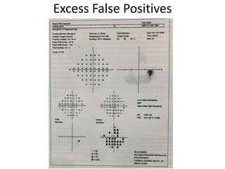 Excess False Positives
 