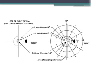 Perimeter Visual Example Comprehensive Overview of Perimetry and Visual Field Assessment ...