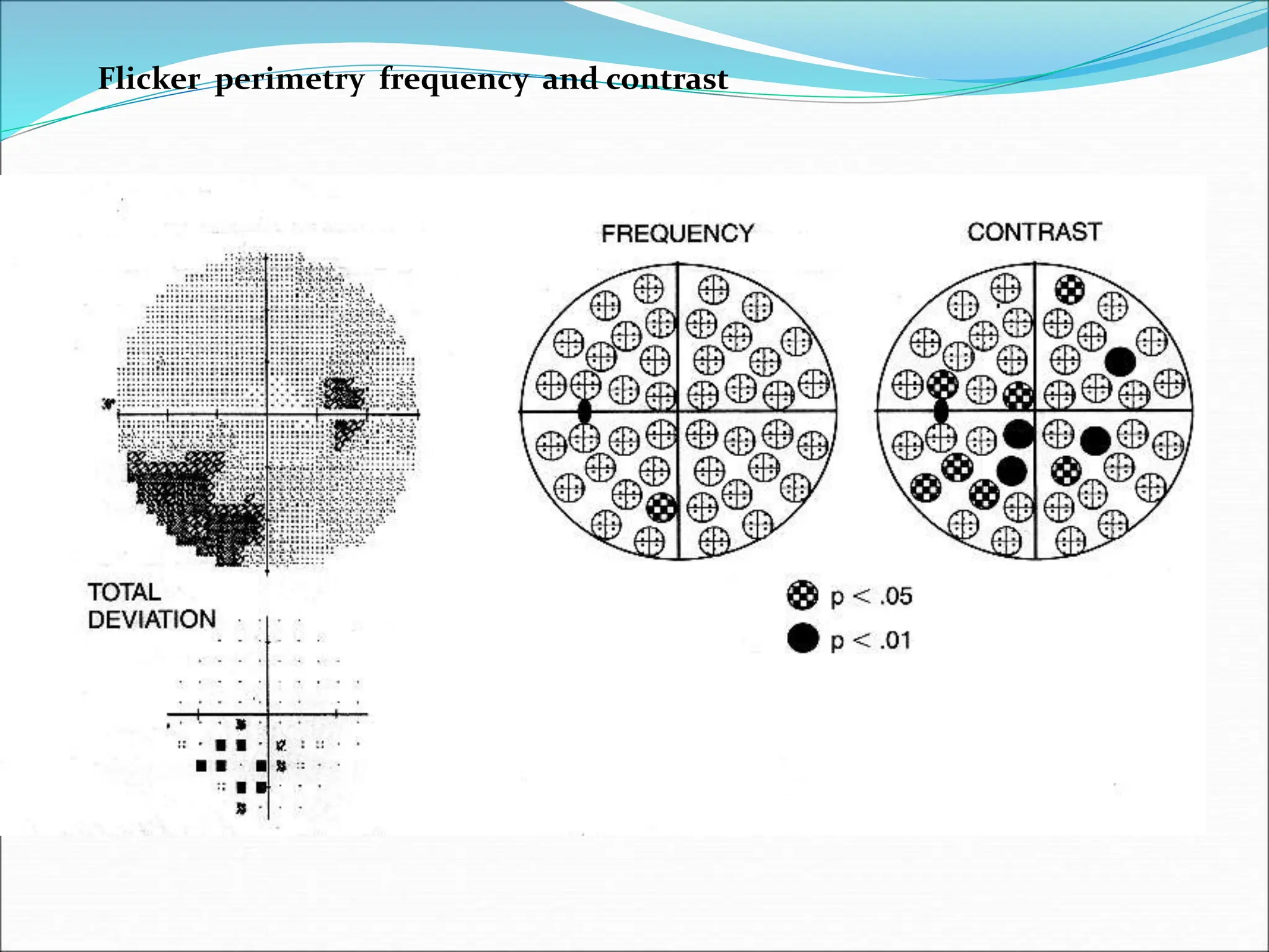 Flicker perimetry frequency and contrast
 