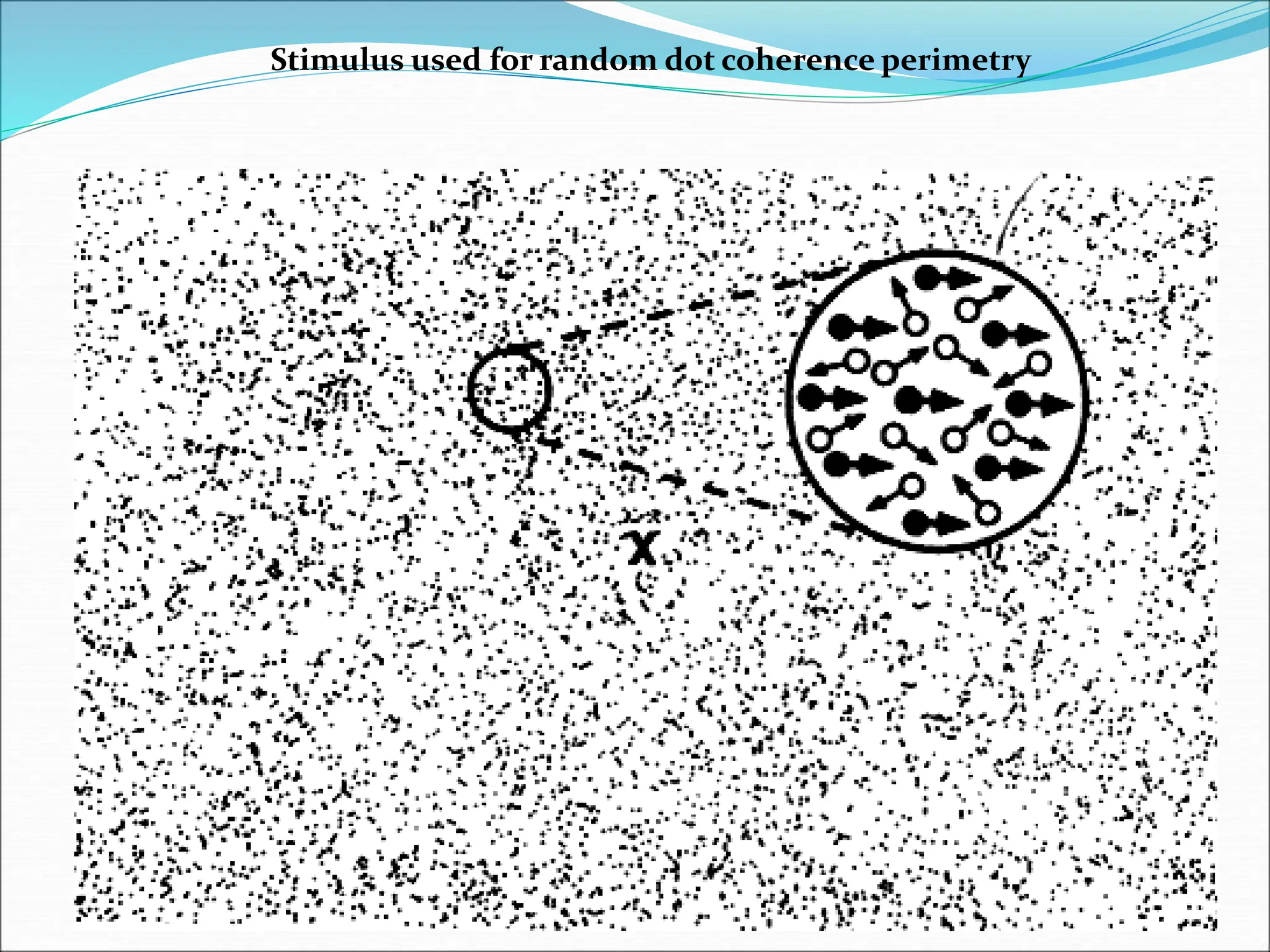 Stimulus used for random dot coherence perimetry
 