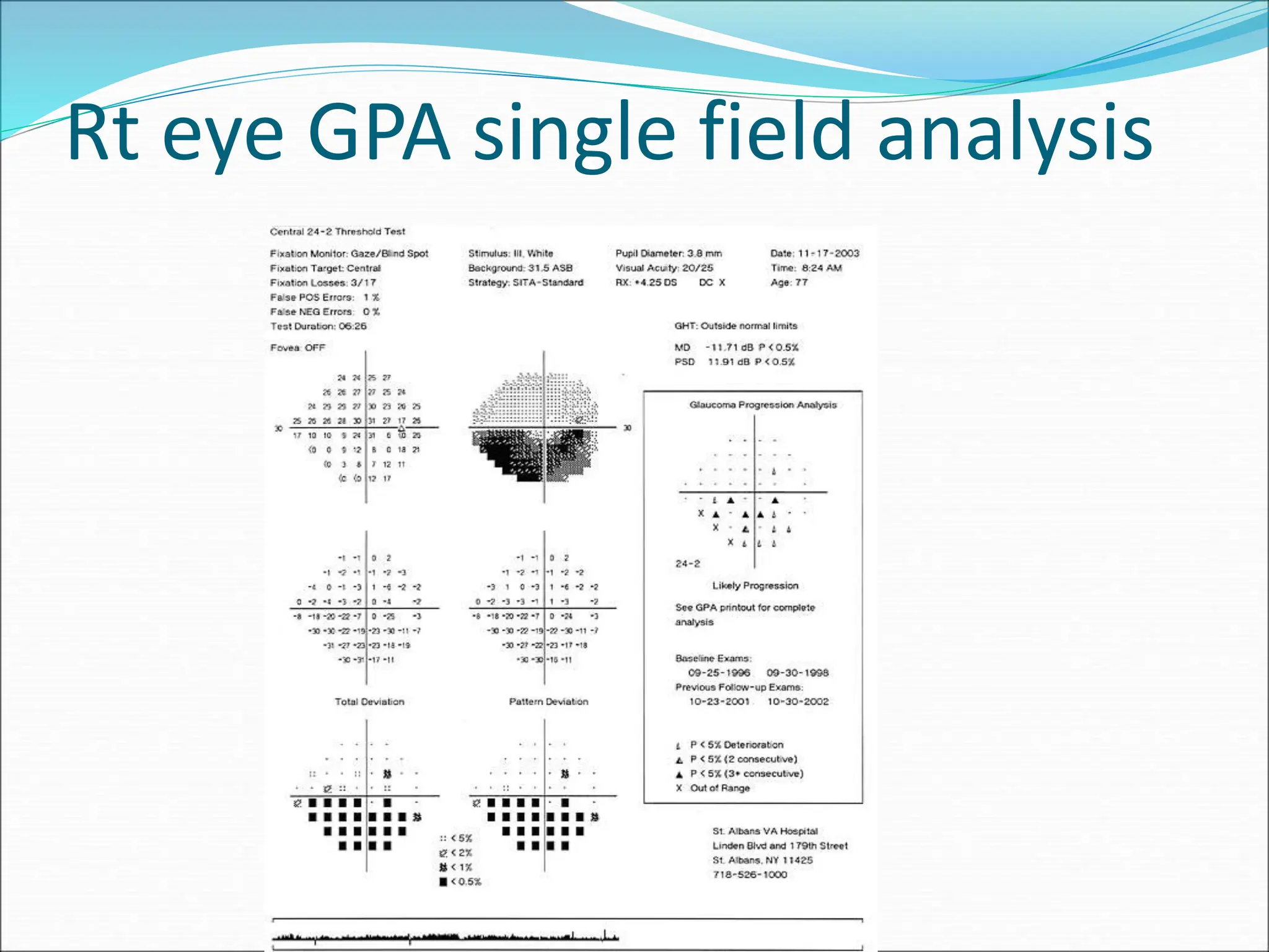 Rt eye GPA single field analysis
 