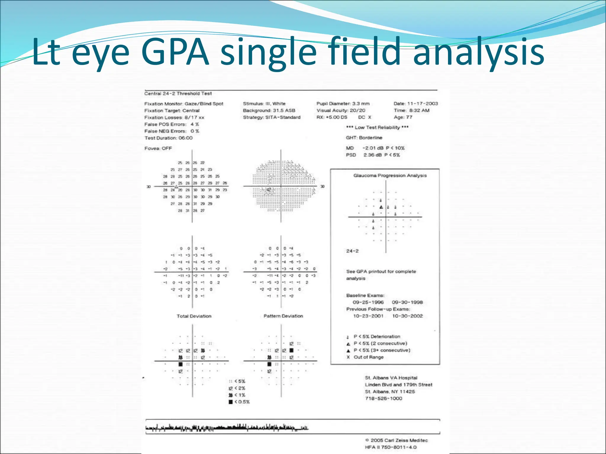 Lt eye GPA single field analysis
 