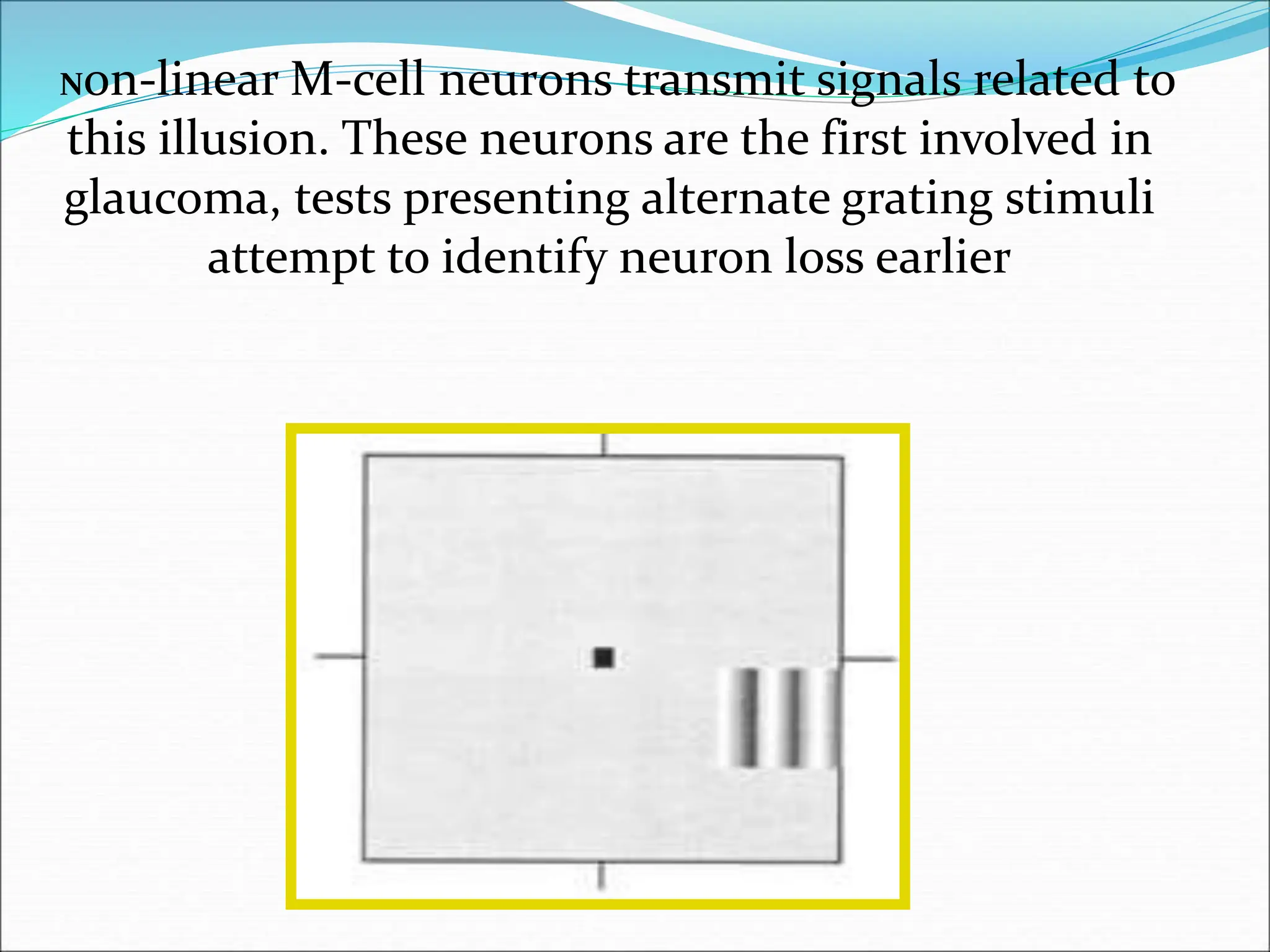 Non-linear M-cell neurons transmit signals related to
this illusion. These neurons are the first involved in
glaucoma, tests presenting alternate grating stimuli
attempt to identify neuron loss earlier
 