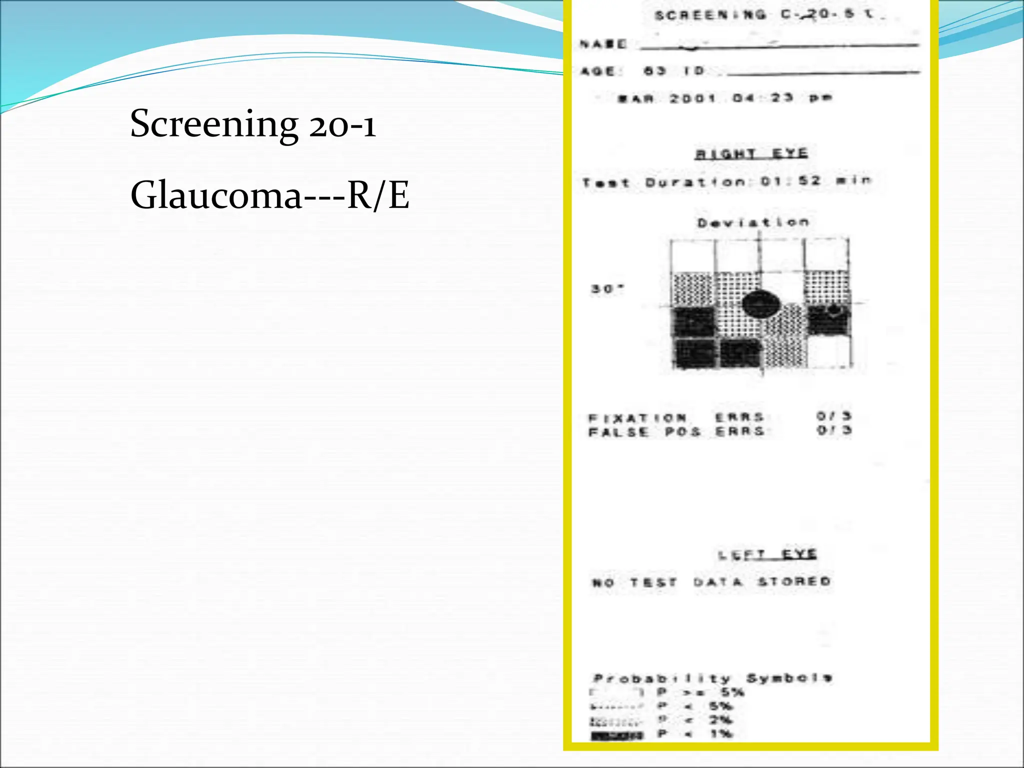 Screening 20-1
Glaucoma---R/E
 