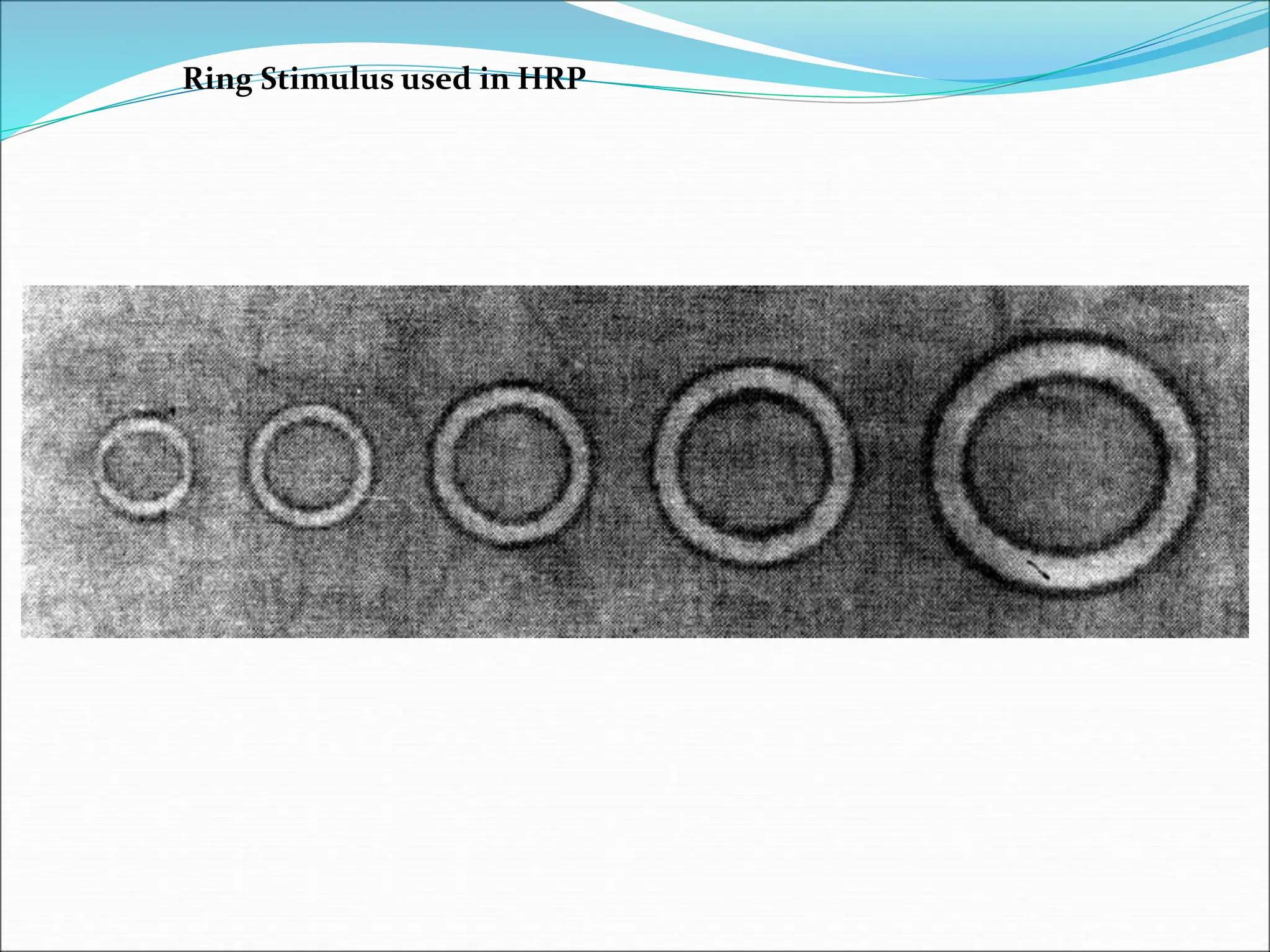 Ring Stimulus used in HRP
 