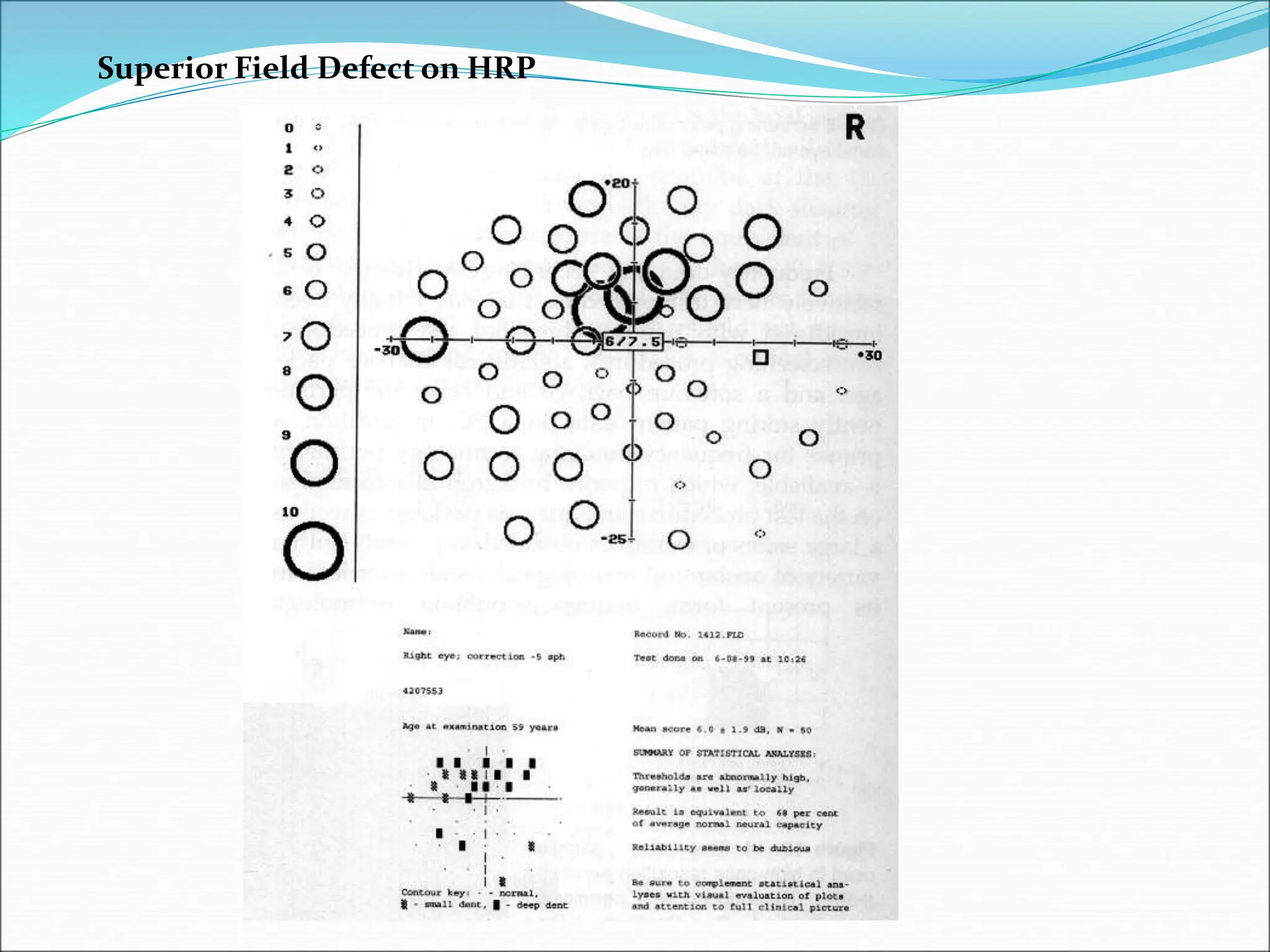 Superior Field Defect on HRP
 