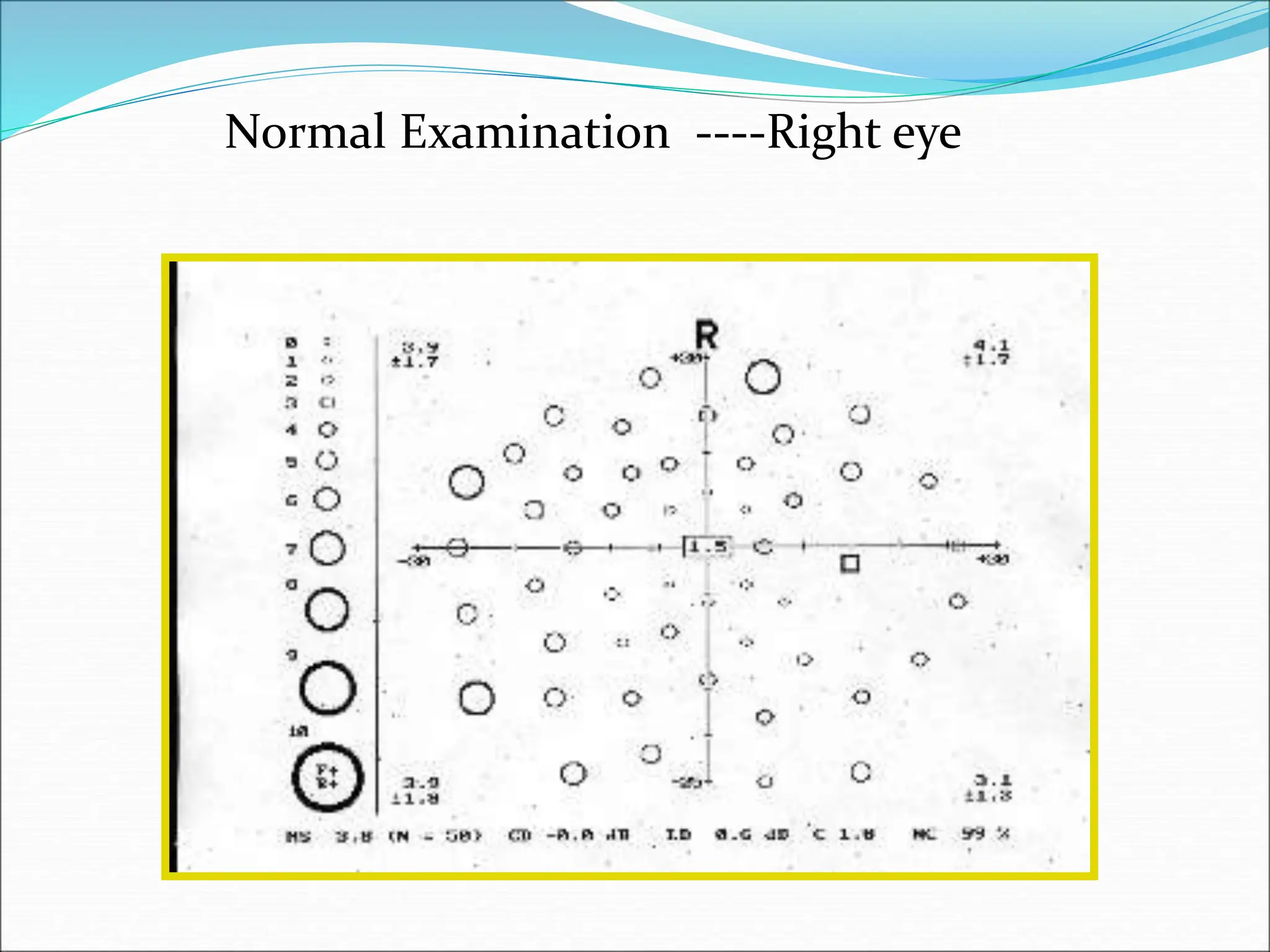 Normal Examination ----Right eye
 