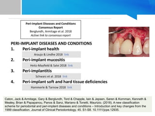 PERIMUCOSITIS AND IMPLANTITIS SEMINAR.pptx