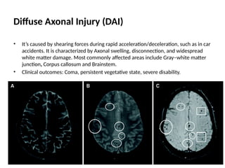 Comprehensive Overview of Perinatal CNS Injuries and Traumatic Brain ...