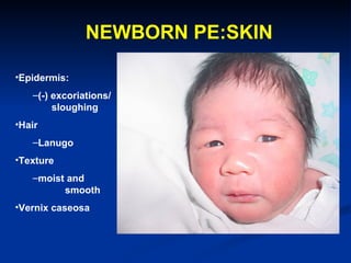 NEWBORN PE:SKIN
   Cysts: Milia,
        pinpoint white papules of keratogenous
        material usually on nose    and ...