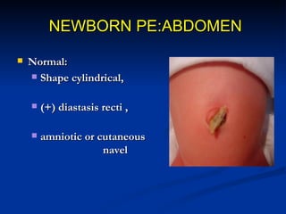 NEWBORN PE:ABDOMEN
   Check for:
     Distention, scaphoid abdomen,
      umbilicus granuloma,
     hernia, inflammatio...