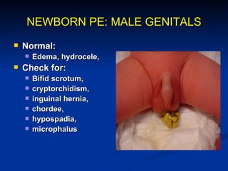NEWBORN PE: FEMALE GENITALS

   Normal:
       Mucoid or bloody
        secretion, edema,
        gaping labia,
        ...