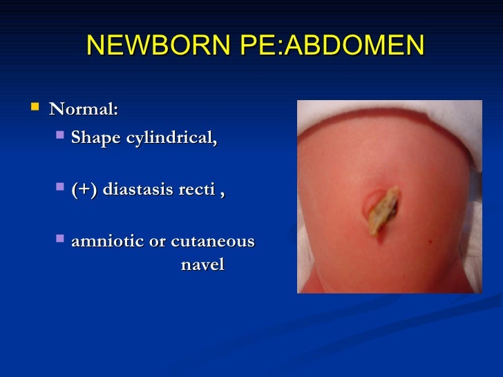 Perinatal history, normal newborn
