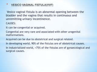 Vesico vaginal fistula is an abnormal opening between the
bladder and the vagina that results in continuous and
unremitting urinary incontinence.
CAUSES:
It can be congenital or acquired.
Congenital are very rare and associated with other urogenital
malformations.
Acquired can be due to obstetrical and surgical related.
In developing world, 90% of the fistulas are of obstetrical causes.
In industrialized world, >75% of the fistulas are of gynaecological and
surgical causes.
*
 