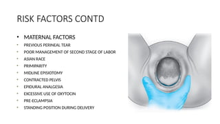 RISK FACTORS CONTD
• MATERNAL FACTORS
PREVIOUS PERINEAL TEAR
POOR MANAGEMENT OF SECOND STAGE OF LABOR
ASIAN RACE
PRIMIPARITY
MIDLINE EPISIOTOMY
CONTRACTED PELVIS
EPIDURAL ANALGESIA
EXCESSIVE USE OF OXYTOCIN
PRE-ECLAMPSIA
STANDING POSITION DURING DELIVERY
 