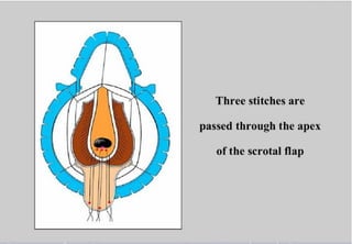 Perineal urethrostomy