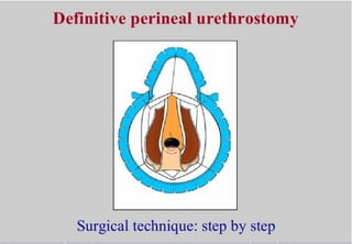 Perineal urethrostomy