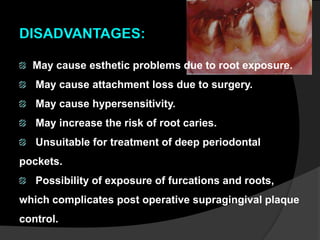 DISADVANTAGES: 
May cause esthetic problems due to root exposure. 
May cause attachment loss due to surgery. 
May cause hypersensitivity. 
May increase the risk of root caries. 
Unsuitable for treatment of deep periodontal 
pockets. 
Possibility of exposure of furcations and roots, 
which complicates post operative supragingival plaque 
control. 
 