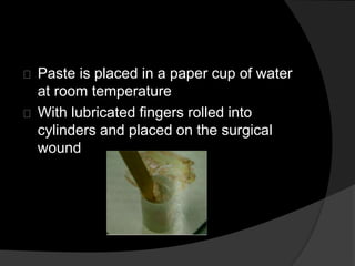 Paste is placed in a paper cup of water 
at room temperature 
With lubricated fingers rolled into 
cylinders and placed on the surgical 
wound 
 