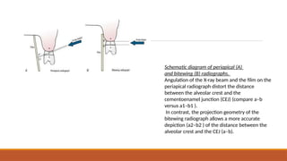 RADIOGRAPHIC AIDS IN DIAGNOSIS OF PERIODONTAL DISEASE | PPTX