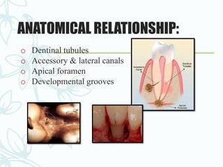 ANATOMICAL RELATIONSHIP:
o Dentinal tubules
o Accessory & lateral canals
o Apical foramen
o Developmental grooves
 