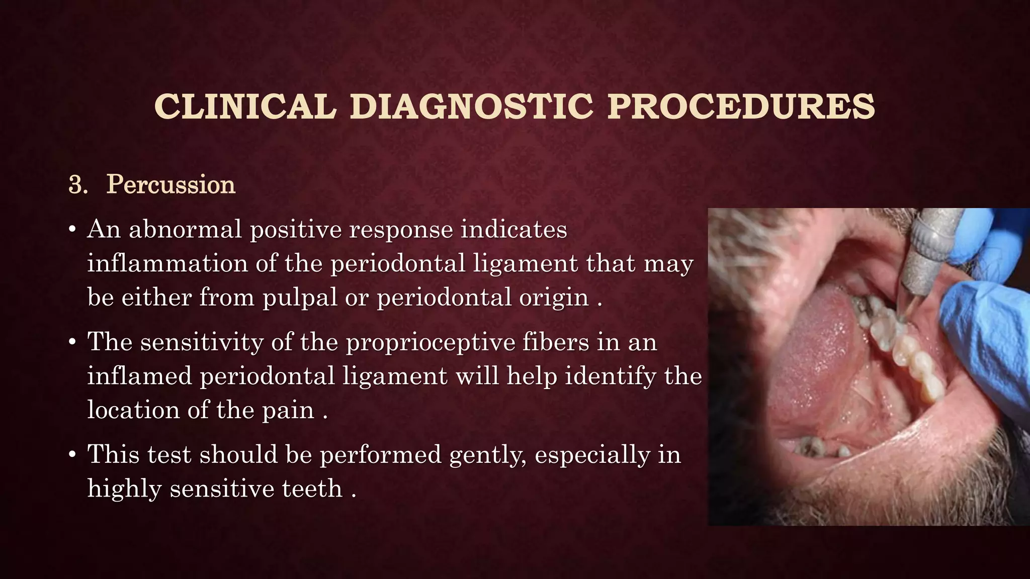 EndoPerio Lesions PPT
