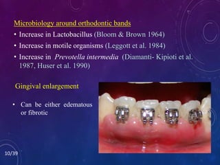 Microbiology around orthodontic bands
• Increase in Lactobacillus (Bloom & Brown 1964)
• Increase in motile organisms (Leggott et al. 1984)
• Increase in Prevotella intermedia (Diamanti- Kipioti et al.
1987, Huser et al. 1990)
10/39
Gingival enlargement
• Can be either edematous
or fibrotic
 