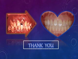 Perio-Ortho interrelationships - Dr.Malvika