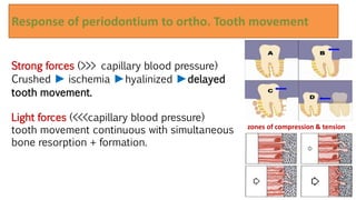 Response of periodontium to ortho. Tooth movement
23
zones of compression & tension
Strong forces (>>> capillary blood pressure)
Crushed ► ischemia ►hyalinized ►delayed
tooth movement.
Light forces (<<<capillary blood pressure)
tooth movement continuous with simultaneous
bone resorption + formation.
 