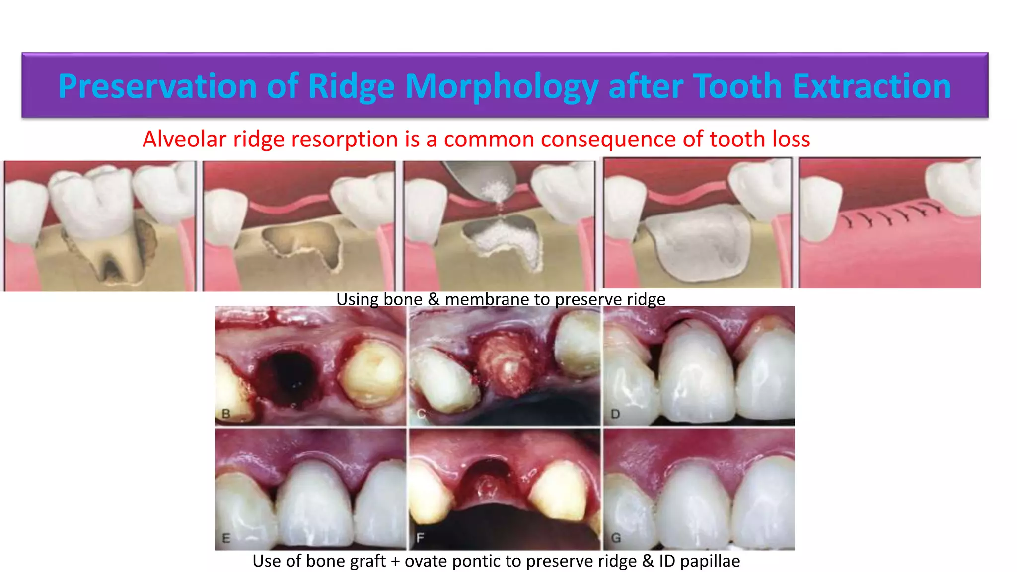 Perio resorative inter-relationship. | PPTX