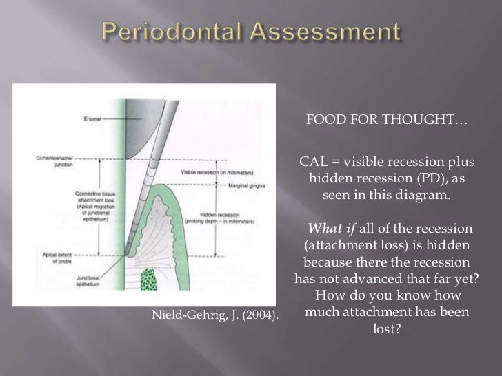 Perio assessment