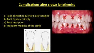 Biological width by Dr.Ali Mohammed AbuTrab | PPTX
