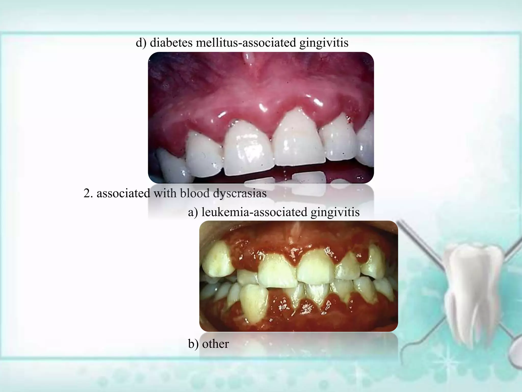 Per Rio Classification Classification of periodontal diseases and conditions past and present ...