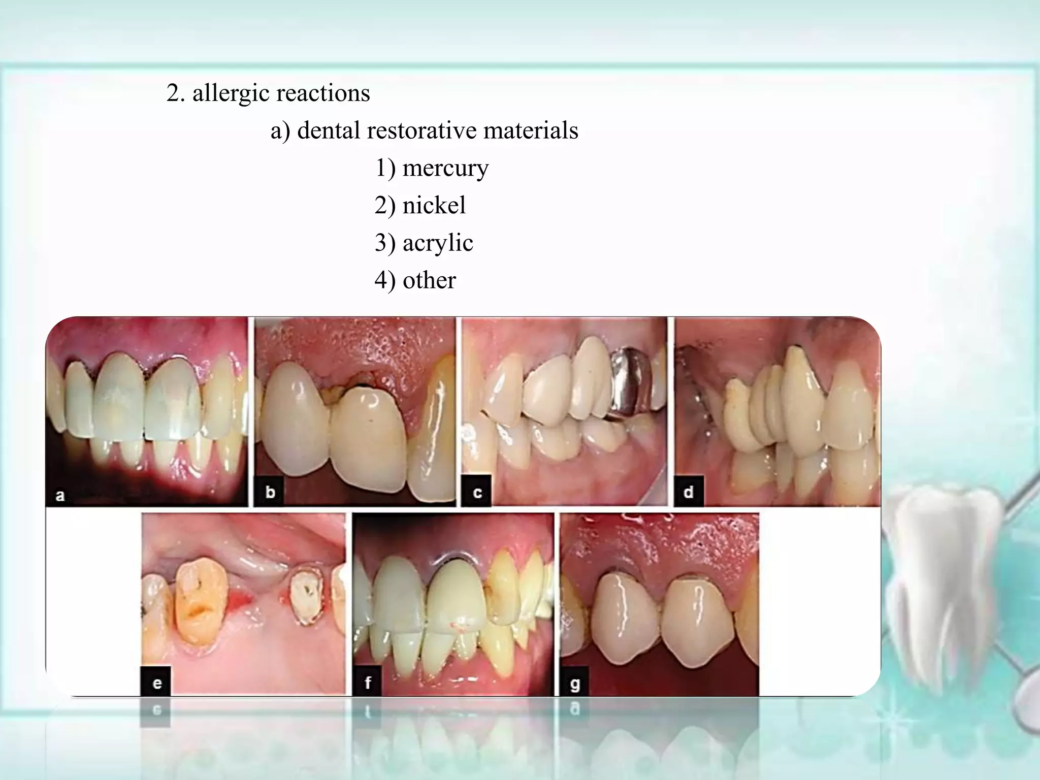 Per Rio Classification Classification of periodontal diseases and conditions past and present ...