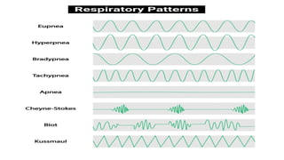 Respirataory physiology periodic breathing-1.pptx